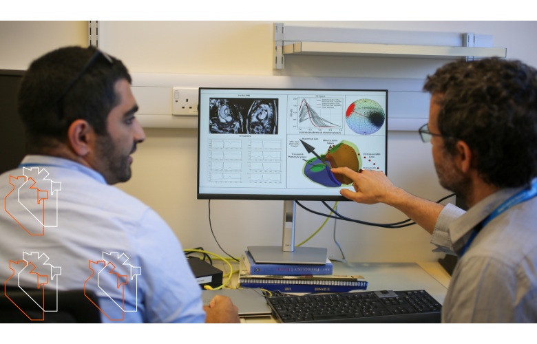 Image: Researchers have unlocked the heart’s hidden geometry that could revolutionize ECG interpretation (Photo courtesy of KCL)