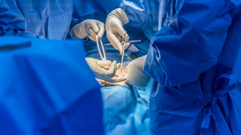 Image: A new surgical method has been found to be effective for both femoral and inguinal groin hernias (Photo courtesy of Adobe Stock)