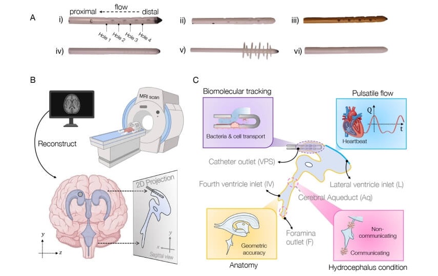 Image: Schematic of approach to simulating brain shunt fluid dynamics (Photo courtesy of Haritosh Patel/Harvard SEAS)