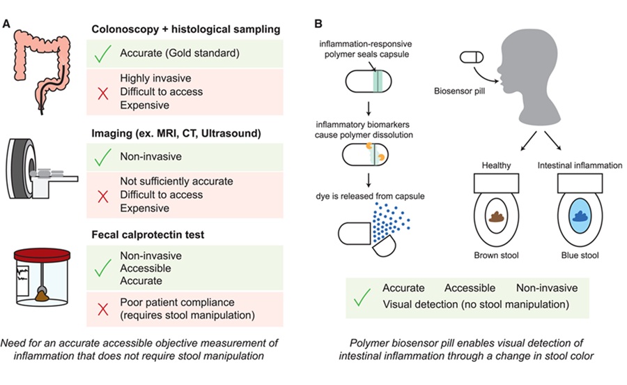 Image: Schematic of modalities for inflammation monitoring in IBD, including the new biosensor pill (Zhuang et al., Device, 2025, DOI: 10.1016/j.device.2025.100865)