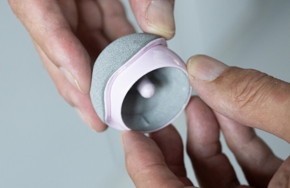 Image: The implant enabling women to access hip resurfacing surgery has been awarded the CE mark (Photo courtesy of Embody Orthopedic)