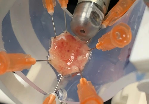 Image: Capsule during scanning of a human esophageal resection (Photo courtesy of Christian Zakian/Helmholtz Munich)