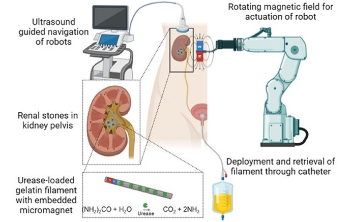 Image: Concept of minimally invasive kidney stone dissolution by enzyme-loaded magnetic small scale robots (Khabbazian A et al., Adv Healthc Mater, 2025; DOI: 10.1002/adhm.202403423)