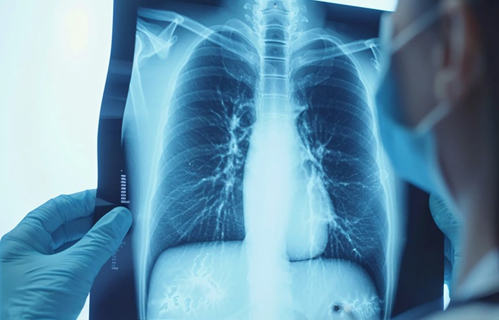 Image: The new approach is potentially practice-changing by enabling a diagnosis of COPD in individuals without airflow obstruction (Photo courtesy of UAB)