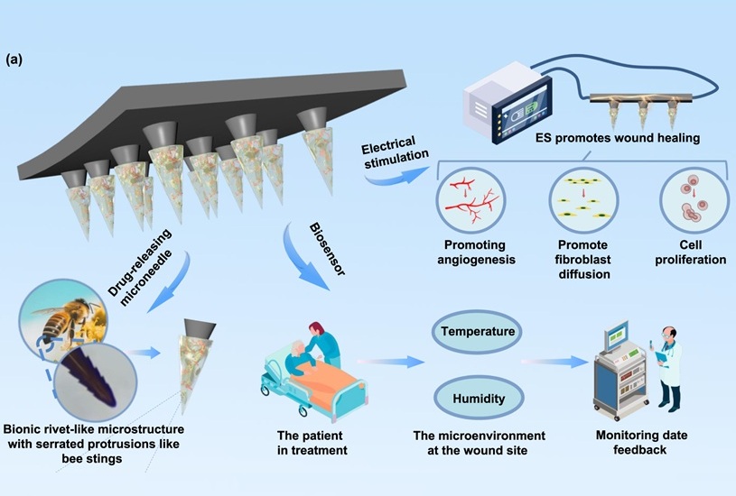 Image: This innovative approach combines bioelectronics with intelligent drug delivery and microneedling technology (Huie Jiang et al 2025 Int. J. Extrem. Manuf.; DOI 10.1088/2631-7990/adeb0f)