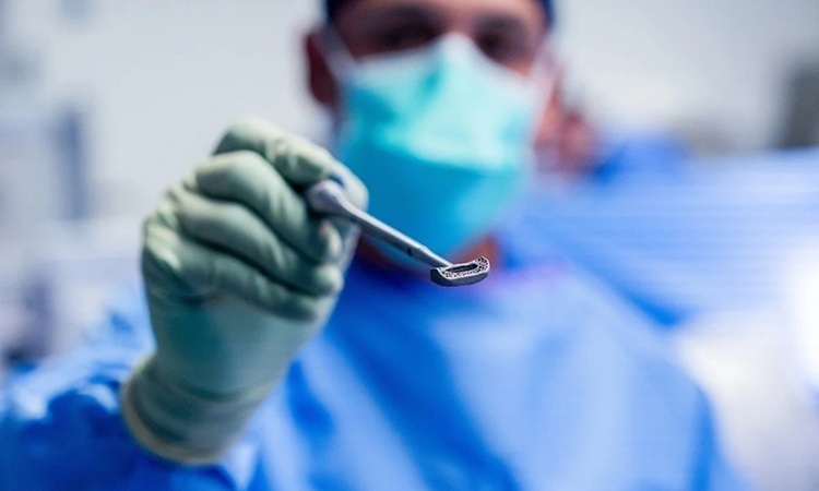 Image: The custom-designed titanium implant made to a patient’s unique spinal anatomy (Photo courtesy of Justin Covington/UC San Diego Health)