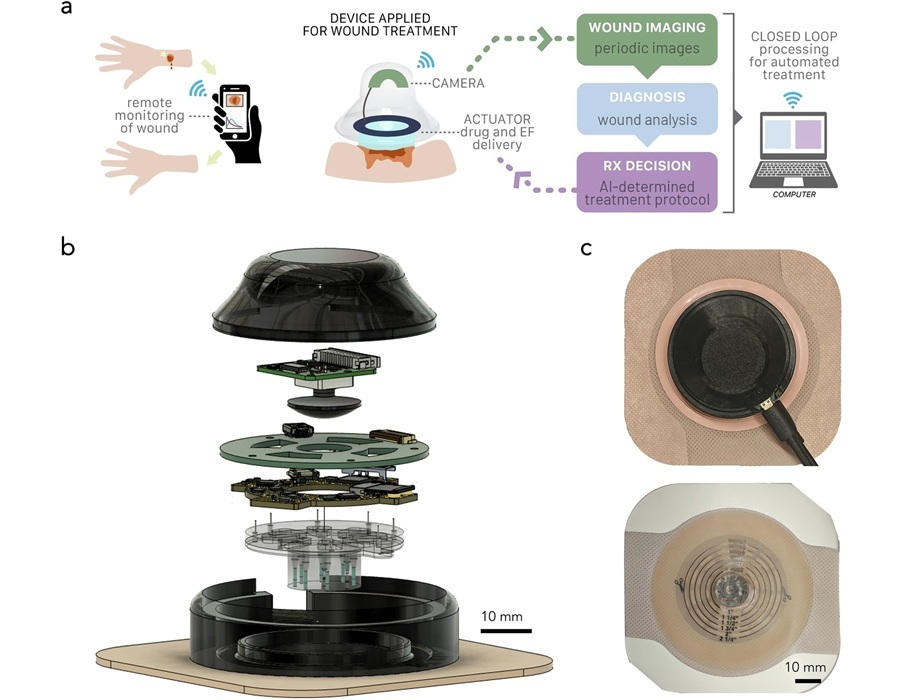 Image: Wireless, integrated system for real-time, onboard, adaptive wound diagnostics and treatment (Li H. et al., npj Biomed Innov (2025). DOI: 10.1038/s44385-025-00038-6)