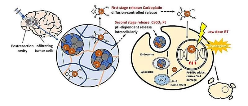 Image: The composite gel can be injected directly into the postresection cavity after tumor bulk excision to achieve local drug delivery (Photo courtesy of Chemical Engineering Journal, 2025. DOI: 10.1016/j.cej.2025.084086)