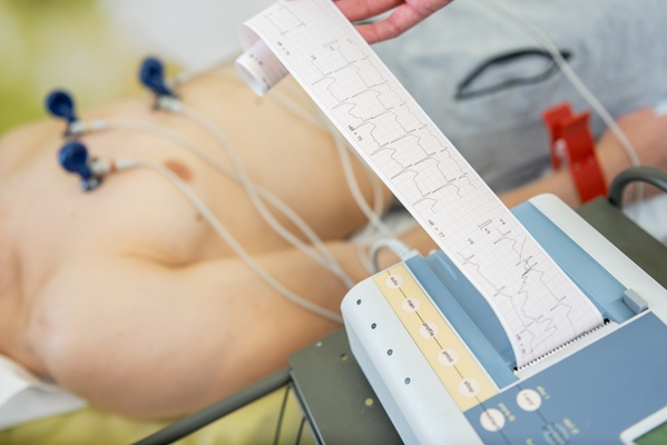 Image: Many young victims of sudden arrhythmic death show warning signs in their ECG readings (Photo courtesy of 123RF)