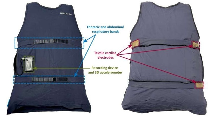 Image: The Hexoskin biometric shirt features electrocardiogram sensors, thoracic and abdominal respiratory bands, 3-axis accelerometer and recording device (St-Jean J. et al., Epilepsia Open (2025). DOI: 10.1002/epi4.70099)