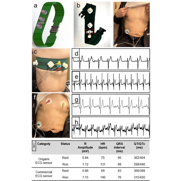 Image: Preparation of the ECG chest strip and monitoring of ECG signals (Chen et al., Biosensors and Bioelectronics; https://doi.org/10.1016/j.bios.2025.118069)