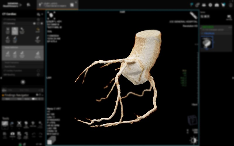 Image: The AI-based heart imaging tool predicts future cardiac events in stable coronary disease (Photo courtesy of 123RF) Image: The AI-based heart imaging tool predicts future cardiac events in stable coronary disease (Photo courtesy of 123RF)