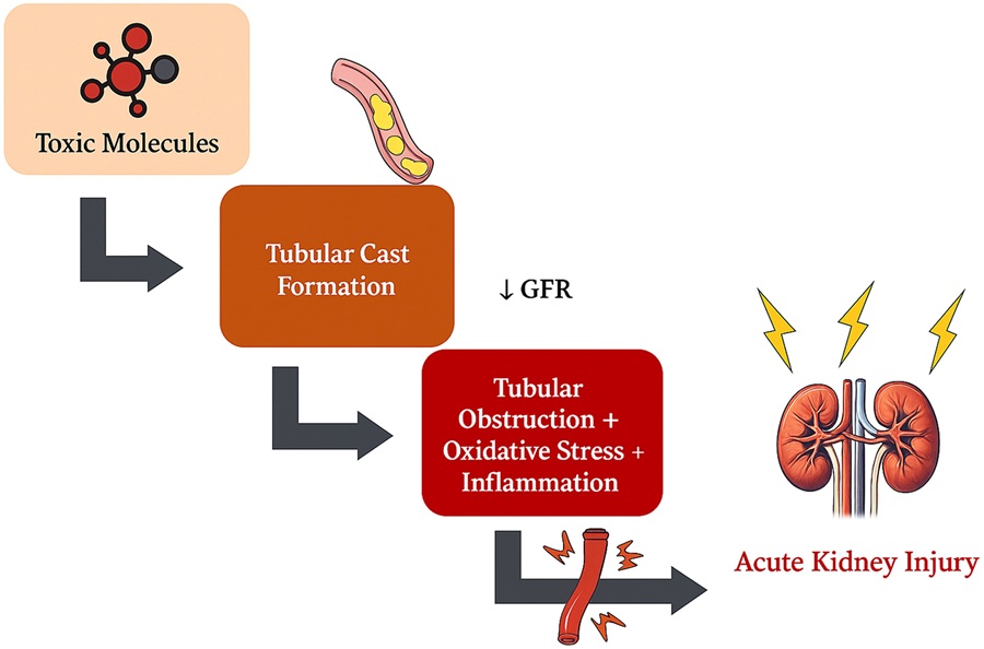 Image: Pathophysiological cascade of cast-induced AKI (Photo courtesy of Professor Silvia De Rosa/University of Trento)
