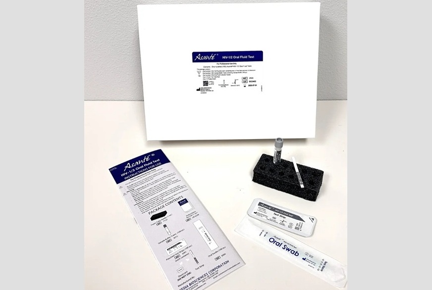 Image: The WHO-approved Asanté HIV-1/2 Oral Fluid Test brings rapid, non-invasive diagnosis to POC settings (Photo courtesy of Sedia Biosciences)