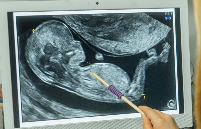 Image: A new therapeutic approach, performed in utero, may prevent babies from being born with a spongy heart (Photo courtesy of University of Houston)