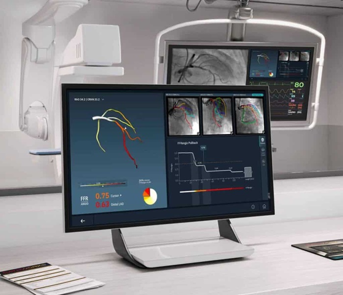 Image: Medtronic’s intent to acquire CathWorks follows a 2022 strategic partnership with a co-promotion agreement for the FFRangio System (Photo courtesy of CathWorks)