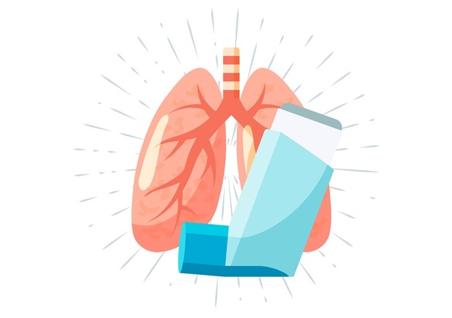 Image: Inhaled rifampin-loaded nanoparticles offer a long-acting alternative to daily oral TB therapy (Photo courtesy of 123RF)