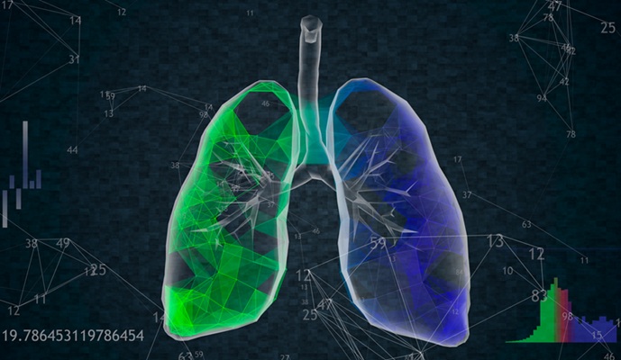 Image: The AI model automatically outlines lung lobes on CT scans to help assess radiation toxicity risk (Photo courtesy of 123RF)