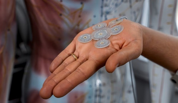 Image: The system uses a thin electrode positioned under the scalp and on top of the skull to deliver electrical pulses to the cortical region where seizures originat (Photo courtesy of PRECISIS GmbH)