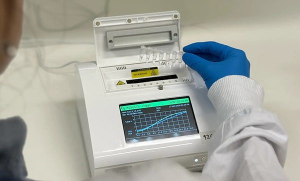 Image: With STIs on the rise, this new test arrives at a critical moment (Photo courtesy of Anthea Jessica Himawan Hardosubroto and Dheeraj Nurani Venkatachalam/Doherty Institute)