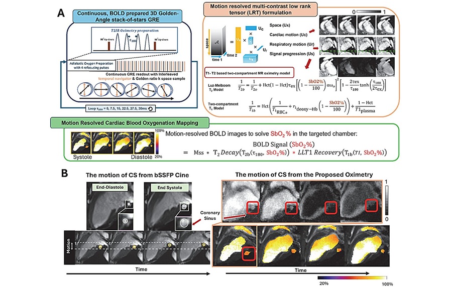Image: The proposed free-running, motion-resolved 3D MR oximetry framework for reliable coronary sinus blood oxygenation mapping (Science Translational Medicine (2026). DOI: 10.1126/scitranslmed.ady6269) Image: The proposed free-running, motion-resolved 3D MR oximetry framework for reliable coronary sinus blood oxygenation mapping (Science Translational Medicine (2026). DOI: 10.1126/scitranslmed.ady6269)