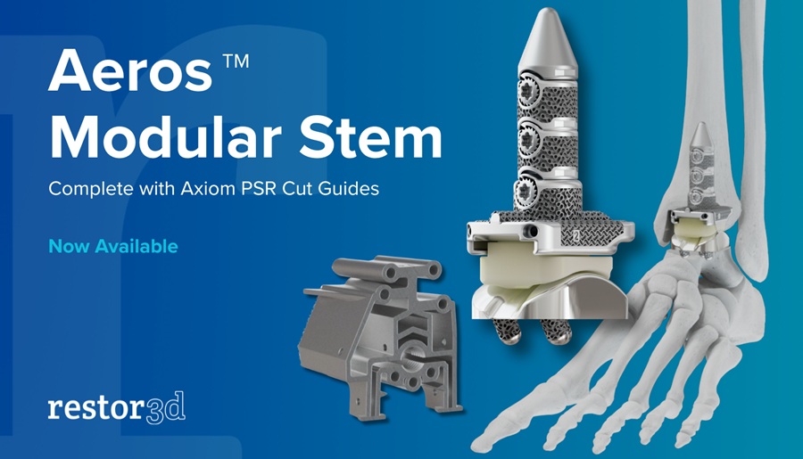 Image: The Aeros Modular Stem System is now commercially available in the United States (photo courtesy of restor3d)
