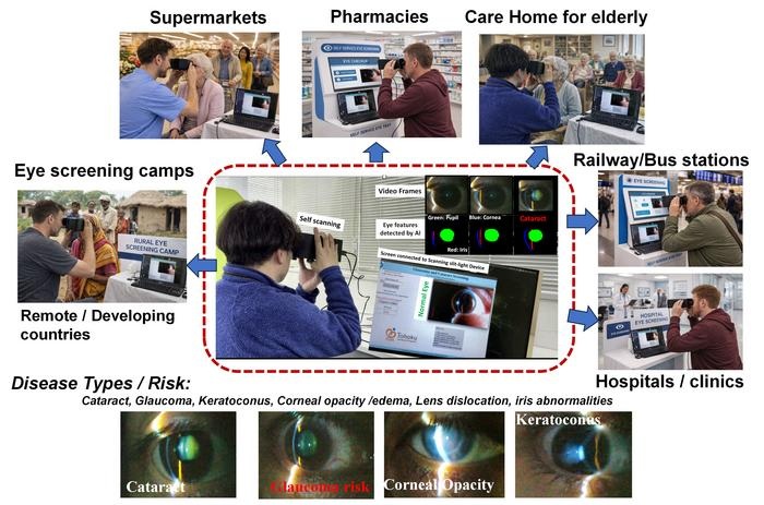 Image: Portable AI-powered scanning slit-light device brings low-cost eye screening closer to everyday life (	Kaushik, N., Sharma, P., Miya, T. et al. Scientific Reports, 2026. doi.org/10.1038/s41598-026-44392-w)