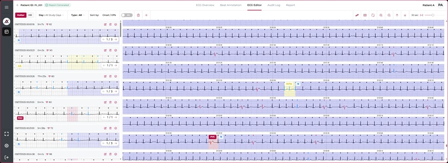 Image: AccurECG 2.0 is an FDA-cleared, API-driven analytics engine designed to integrate with device manufacturers and testing facilities (photo courtesy of  AccurKardia)