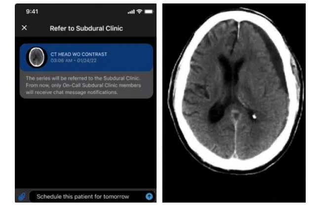 Image: The Viz Subdural solution is powered by the Viz.ai platform and includes Viz Assist, which provides artificial intelligence–driven chart summarization (photo courtesy of Viz.ai)
