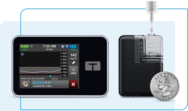 Image: Tandem Diabetes Care's t:slim X2 and Tandem Mobi are the first and only commercially available AID systems FDA-cleared for pregnancy use in the U.S. (ph