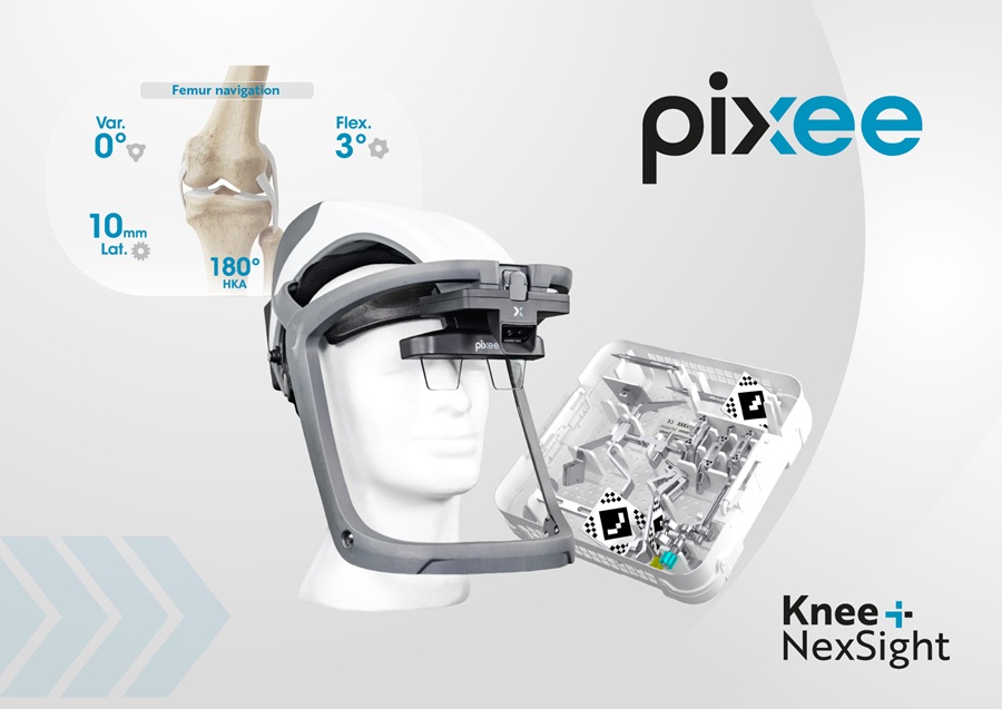Image:KNEE+ NEXSIGHT officially received FDA 510(k) clearance (Photo courtesy of Pixee Medical)
