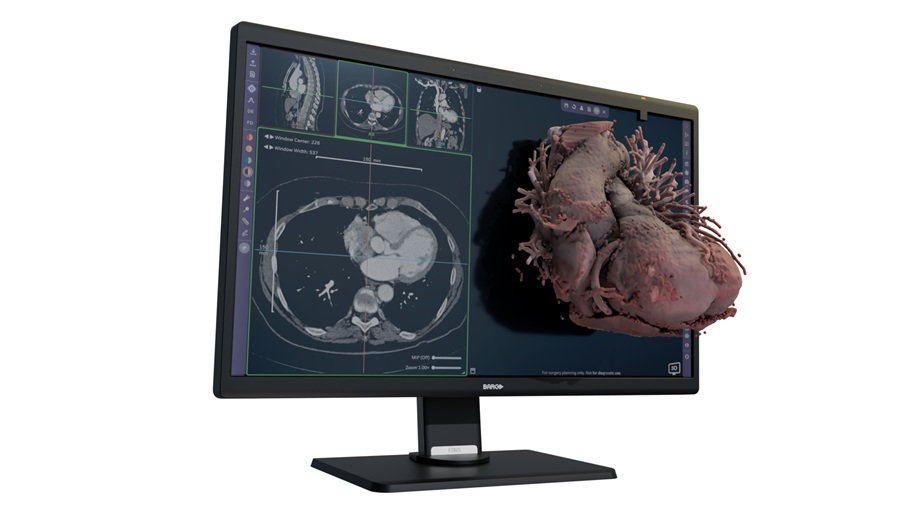 Image: The platform enables clinicians to process and interact with CT and MR data as spatial, multi-dimensional representations (photo courtesy of Avatar Medical)