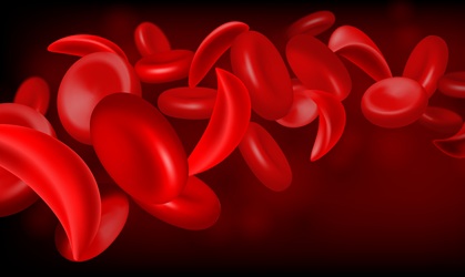 Image: Many sickle cell transplant candidates lack fully matched donors, while intensive conditioning can damage organs and fertility. Safer regimens are needed to expand donor options while limiting toxicity (image credit: Shutterstock)