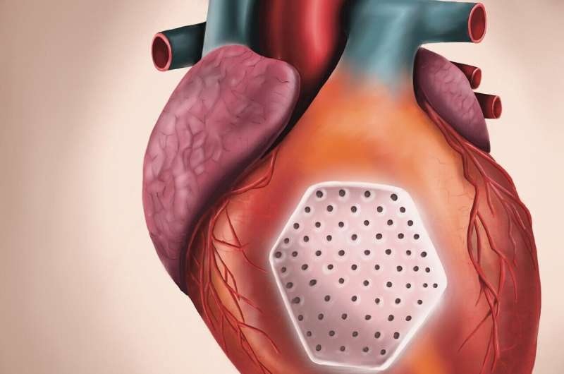Image: Significant progress in the treatment of severe heart failure: For the first time, a clinical trial has demonstrated that laboratory-grown heart muscle tissue can improve the pumping function of damaged hearts (Photo courtesy of University Medical Center Göttingen)
