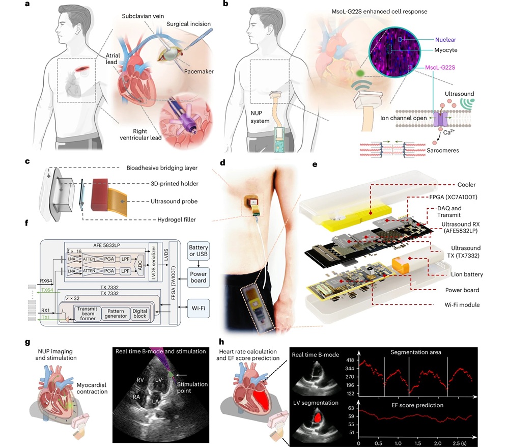 Image: Overview and mechanism of the NUP system (Chen Gong et al., Nature Biomedical Engineering (2026). DOI: 10.1038/s41551-026-01673-z)
