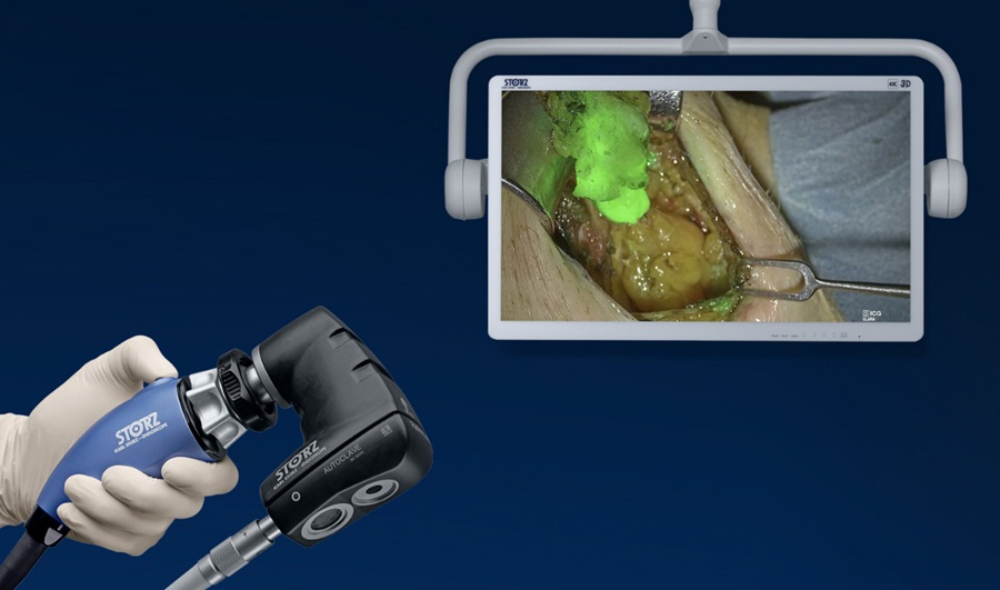 Image: The Rubina Lens digital exoscope displays a magnified 4K image of the surgical field on a monitor. The ability to switch to NIR/ICG fluorescence imaging helps reveal information that cannot be seen with the naked eye (Photo courtesy of Karl Storz)