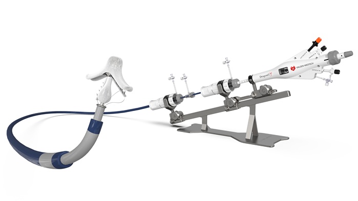 Image: DragonFly Transcatheter Mitral Valve Repair System (Photo courtesy of Valgen Medtech)