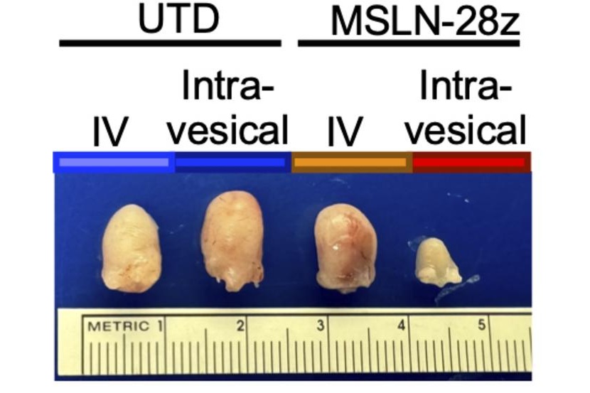 Image: Bladder tumor size is greatly reduced when CAR T cells targeting MUC16 are delivered directly to the bladder via a catheter (right). (Image Credit: © 2026 Abrahimi et al. Originally published in Journal of Experimental Medicine. https://doi.org/10.1084/jem.20250699)