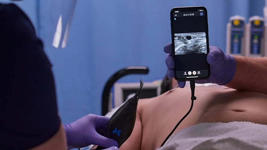 Image: The platform combines proprietary Ultrasound-on-Chip technology with intuitive mobile apps compatible with supported iOS and Android devices (Photo courtesy of Butterfly Network)