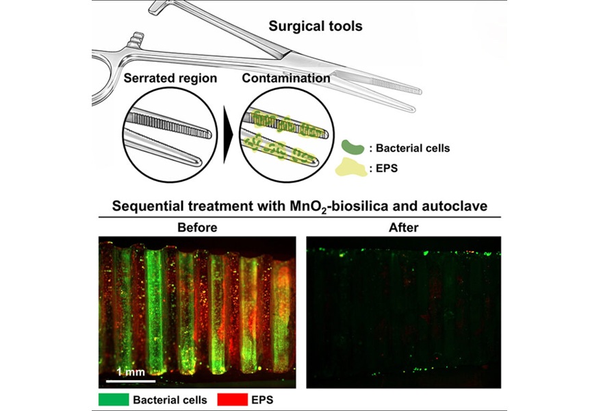 Image: Biofilm, a dense matrix of proteins and bacteria, can hide in the grooves of surgical instruments even after standard cleaning procedures. Bubble-generating microparticles can remove it. (Photo courtesy of Yujin Ahn/University of University of Illinois Urbana-Champaign)