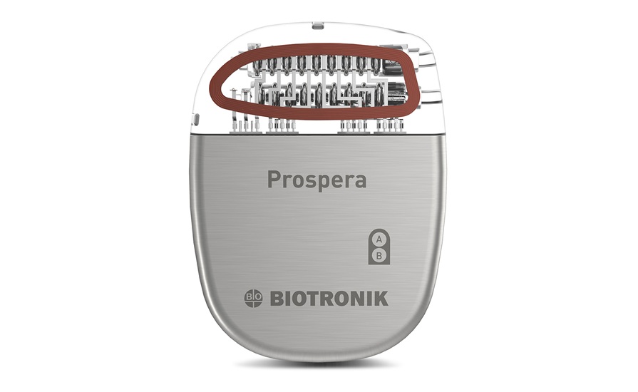 Image: Prospera Spinal Cord Stimulation System (Photo courtesy of BIOTRONIK)
