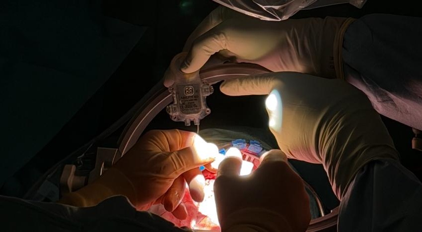 Image: Conducted at the Department of Neurosurgery at TUM University Hospital Rechts der Isar, the procedure marks the first use of ABILITY’s neural signal acquisition technology in a live surgical setting (Photo courtesy of ABILITY Neurotech)