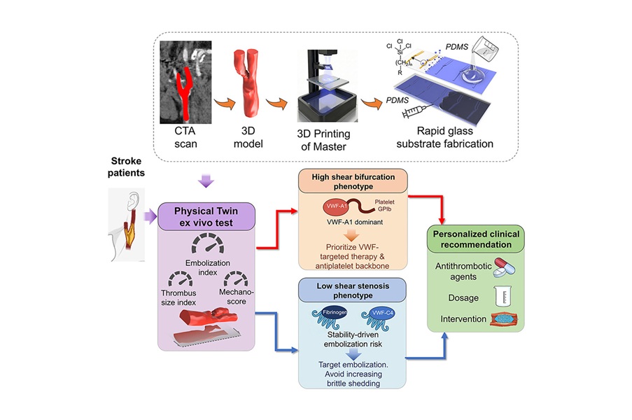 Image: Graphical Abstract (Zhao YC, Liu Y, Wang Z, et al. Patient-specific carotid artery-on-a-chip \