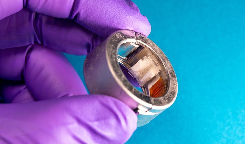 Image: A new smart ring continuously tracks multiple biomarkers at the same time, including glucose, ketones, vitamin C, uric acid, lactate and alcohol (Photo courtesy of David Baillot/UC San Diego Jacobs School of Engineering)