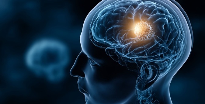 Image: The platform pairs focused ultrasound with an advanced MRI unit that provides detailed views inside the brain, enabling researchers to deliver therapy and monitor its effects with precision (Image Credit: Adobe Stock)