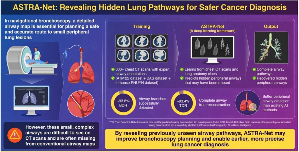 Image: ASTRA-Net can identify previously overlooked lung airways from incompletely annotated CT scans, potentially helping doctors navigate to difficult-to-reach lung lesions. (Image Credit: Professor MinWoo Kim from Pusan National University, Korea)