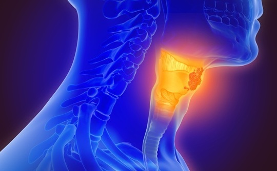 Image: New findings show that chemotherapy plus immunotherapy before surgery produced greater tumor destruction than immunotherapy alone in head and neck cancer patients (Image Credit: Adobe Stock)