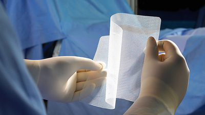 Image: Phasix Mesh is a fully resorbable monofilament scaffold designed for rapid tissue incorporation, combining synthetic mesh repair strength with biologic graft-like remodeling. (Photo courtesy of BD)