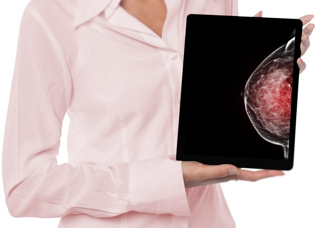 Image: By reusing images already acquired for breast cancer screening, the method could extend cardiovascular risk detection without additional imaging or radiation. (Image Credit: 123RF)