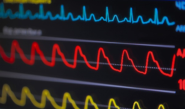 Image: The findings support consideration of early ambulatory monitoring as part of routine ED care for unexplained syncope (Image Credit; 123RF)